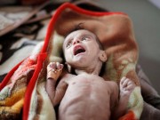 حقوقيون: المجاعة انتشرت في جميع أنحاء قطاع غزة