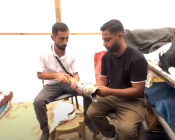 بأدوات بسيطة يصنع الأمل..أخصائي علاج طبيعي ينتج أطراف صناعية لمصابي غزة