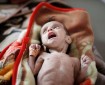 حقوقيون: المجاعة انتشرت في جميع أنحاء قطاع غزة