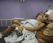 المفوض العام للأونروا: 10 أطفال يفقدون ساقا أو ساقين في قطاع غزة يوميا