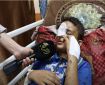 كاميرا الكوفية تنقل شهادات حية لأطفال أصيبوا بسبب مخلفات الحرب في غزة