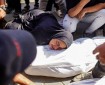 28 شهيدا و125 مصابا جراء 3 مجازر للاحتلال بقطاع غزة