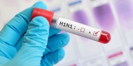 الصحة: 14 إصابة بإنفلونزا الخنازير بالضفة منذ أيلول الماضي