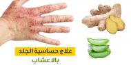 طرق علاج الحساسية الموسمية بالأعشاب