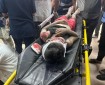 مصابون جراء قصف مدفعية الاحتلال لمنطقة الشيخ ناصر بخان يونس