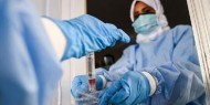 الصحة: 8 وفيات و2675 إصابة جديدة بفيروس كورونا