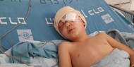 الاحتلال يغلق ملف التحقيق في جريمة إطلاق النار على الطفل مالك عيسى