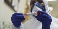 الصحة: 5 وفيات و257 إصابة جديدة بفيروس كورونا