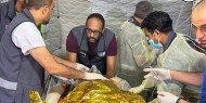 المستشفى الميداني الإماراتي يؤكد مواصلة عمله في رفح رغم تصاعد عمليات الاحتلال
