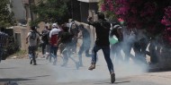3 إصابات بالرصاص خلال قمع الاحتلال مسيرة كفر قدوم الأسبوعية
