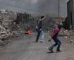 إصابتان بالرصاص المعدني بمواجهات مع الاحتلال في كفر قدوم