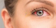 أعراض جديدة للإصابة بكورونا تظهر في العينين