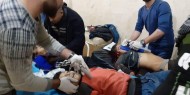 مقتل وإصابة 17 مدنيًا بينهم أطفال في مجزرة تركية جديدة شمال سوريا