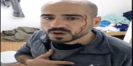 بالفيديو|| مواطن يطالب السنوار وأبو نعيم بالتحقيق مع أمن حجر بيت حانون عقب الاعتداء عليه