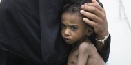 الأمم المتحدة: 9 ملايين يمني تضرروا جراء خفض برامج المساعدات