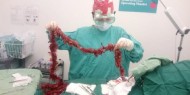 عملية جراحية لإنقاذ كلب ابتلع زينة عيد الميلاد