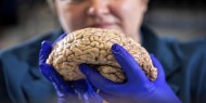 علماء يكتشفون مكان ظهور أول دماغ بشري