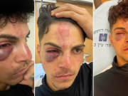 مستعمرون يعتدون بالضرب على فتى في البلدة القديمة من القدس